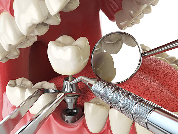 Best Emergency Dental Surgery in Heyville, AL